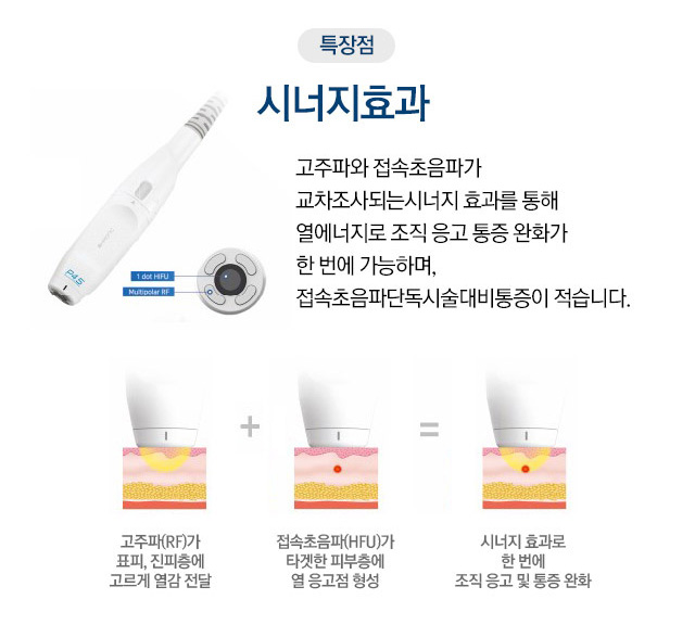 특장점 : 시너지효과 고주파와 접속초음파가 교차조사되는 시너지 효과를 통해 열에너지로 조직 응고 통증 완화가 한 번에 가능하며, 접속초음파단독시술대비통증이 적습니다.