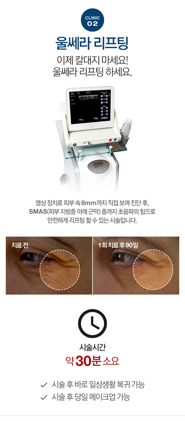 울쎼라 리프팅 이제 칼대지 마세요! 울쎄라 리프팅 하세요! 영상 장치로 피부 속 8mm까지 직접보며 진단 후, SMAS(피부 지방층 아래 근막)층까지 초음파의 히으로 안전하게 리프팅 할 수 있는 시술입니다.